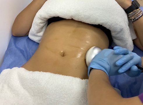 ultracavitacion