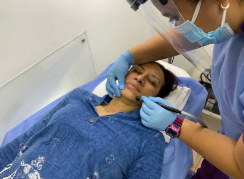 microdermoabrasion