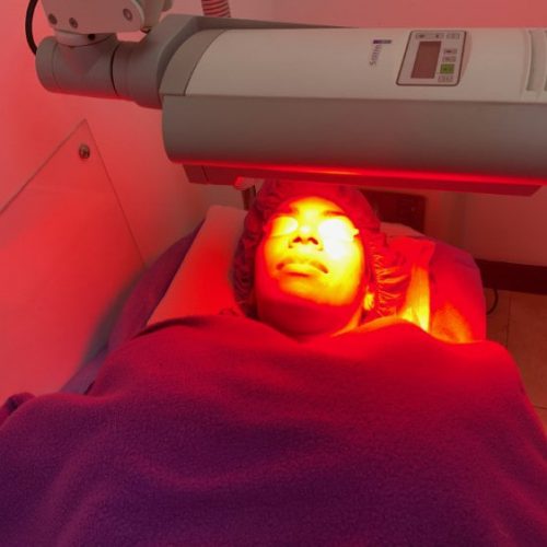 terapia-fotodinamica
